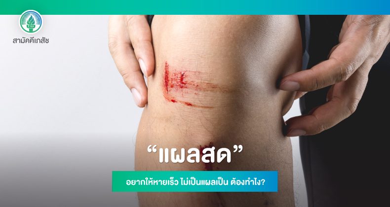 Website-Content-เนเธเธฅเธชเธ”-3